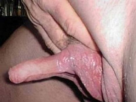你見(jiàn)過(guò)大的陰蒂嗎？最大的有多大？
