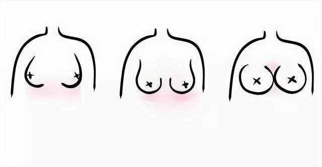 原來女生的胸部形狀有那么多種？東亞女性胸部偏小真是基因所致？