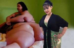 世界最胖的女人(梅拉：世界第一胖，被妹妹陷害遭丈夫拋棄，后狂減800斤實(shí)現(xiàn)蛻變)