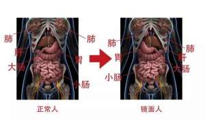 女人左眼跳是好兆頭嗎(南寧一女子五臟六腑全部反著長(zhǎng)，醫(yī)生：罕見的先天性畸形，發(fā)病率約為百萬(wàn)分之一)