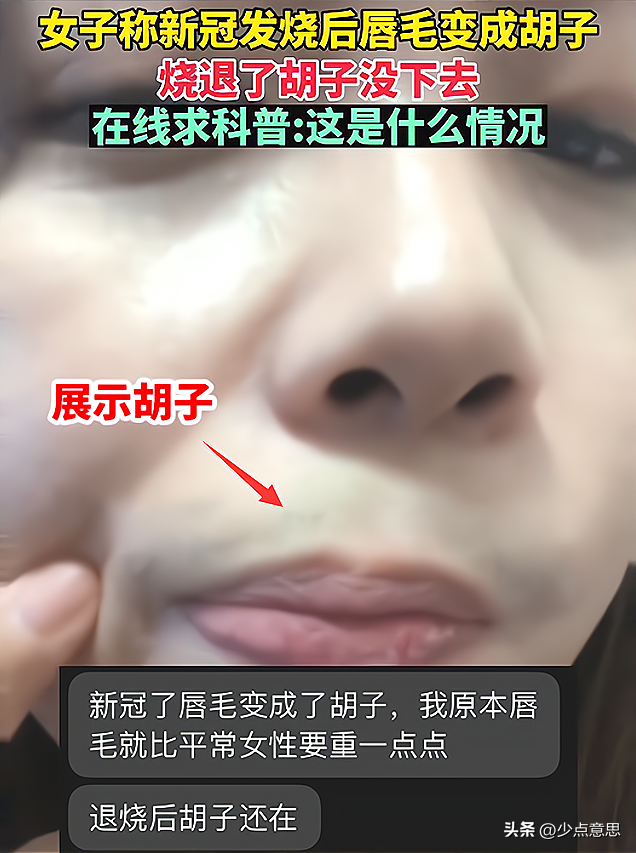 ?江蘇：女子陽(yáng)后長(zhǎng)出來(lái)胡子，被懷疑是特效，“我這怎么出門啊”