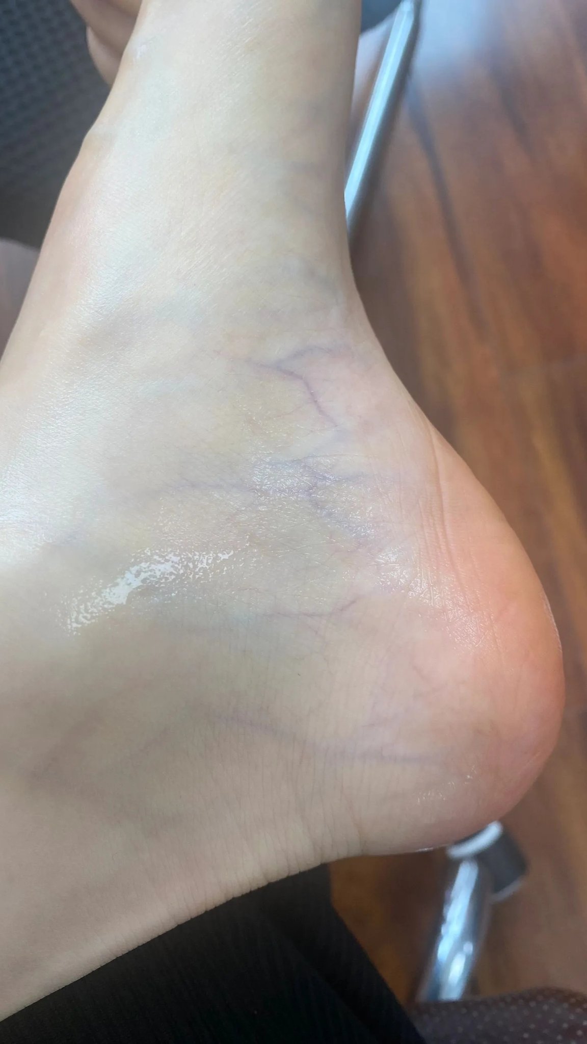 各種腳，包括黃圣依的
